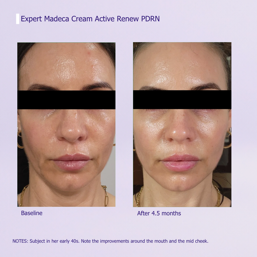 Active Renew Cream