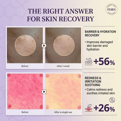 PDRN Active Renew Cream  — Buy 2, Get 1 Free